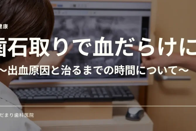 歯石取りで血だらけになる原因