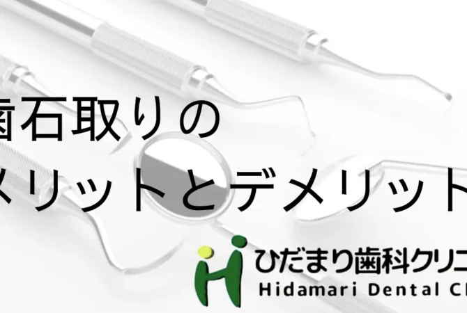 歯石取りのデメリット