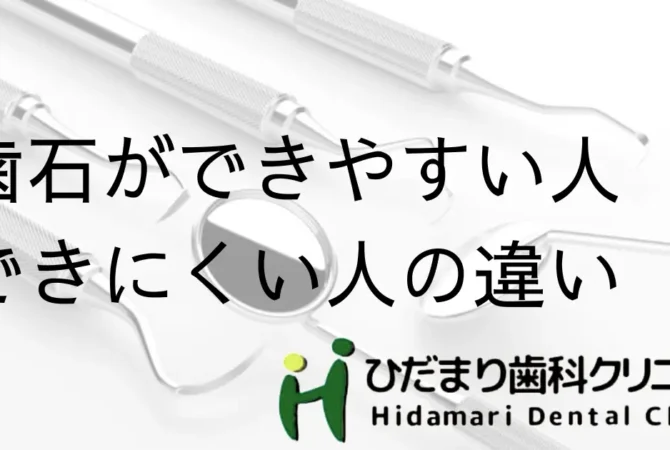 歯石ができやすい人とできにくい人の違い