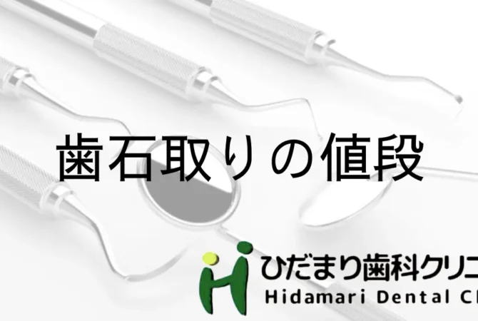 歯石取りの料金