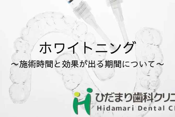 ホワイトニングに必要な時間