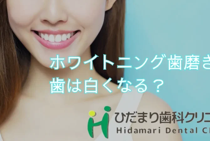 ホワイトニング歯磨き粉