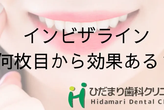 インビザライン