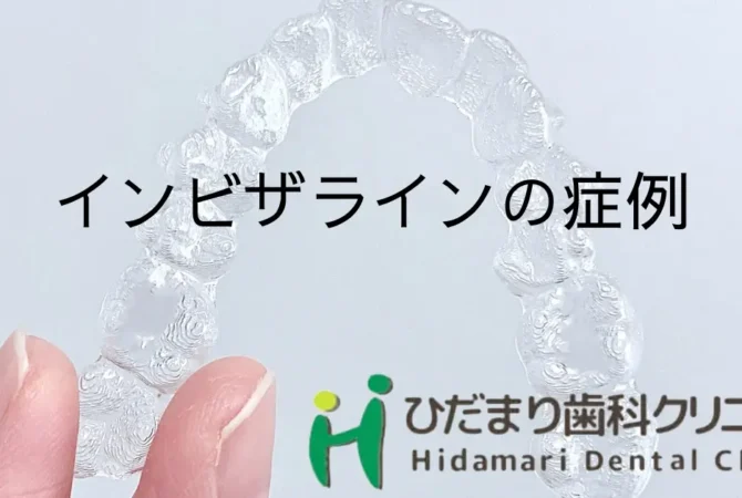 インビザラインの症例