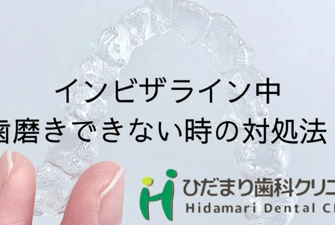 インビザライン中に歯磨きできない？