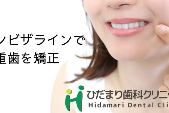 インビザライン 八重歯