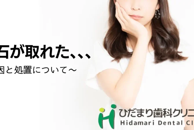 歯石が勝手に取れた