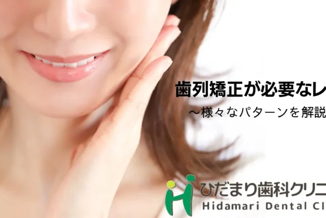 歯列矯正が必要なレベル