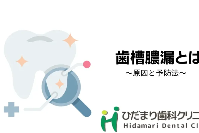 歯槽膿漏