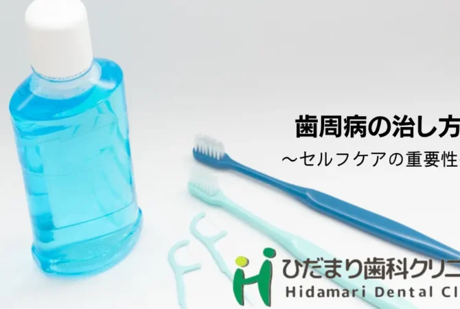 歯周病の治し方