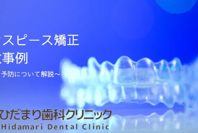 マウスピース矯正で失敗した事例