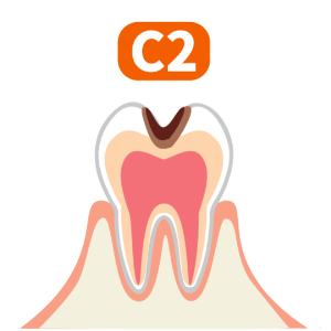 c2