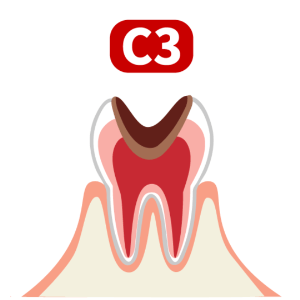 c3