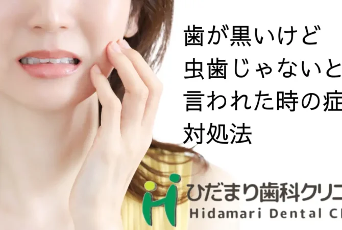 歯が黒いけど虫歯じゃない