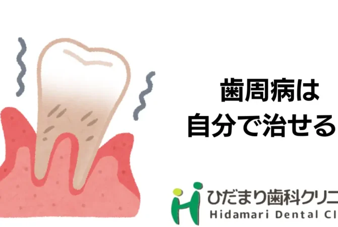 歯周病は自分で治せない