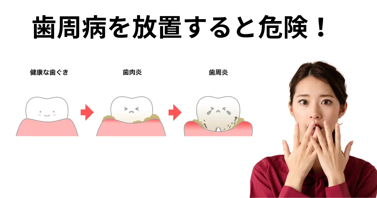歯周病を放置した結果