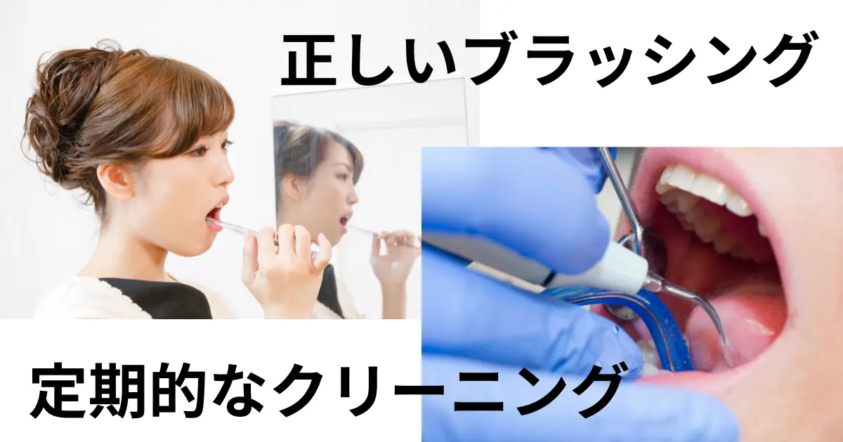 歯石を予防