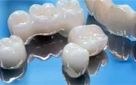 セレック